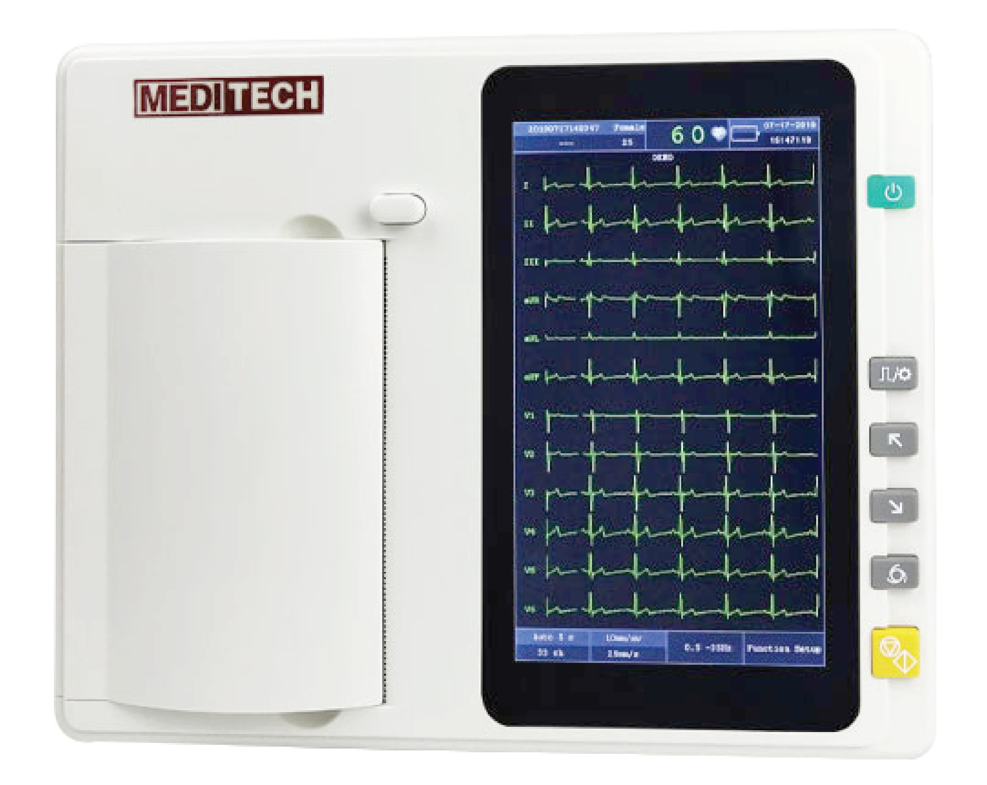 EKG-3A ECG machine